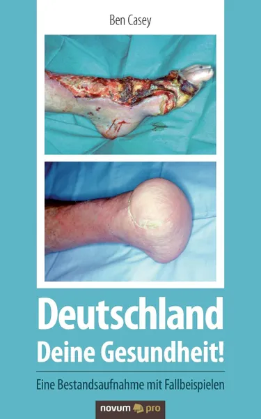 Обложка книги Deutschland - Deine Gesundheit., Ben Casey