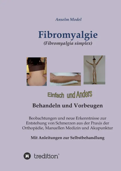 Обложка книги Fibromyalgie (Fibromyalgia simplex) einfach und anders behandeln und vorbeugen, Anselm Dr.Dr. Model