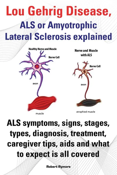 Обложка книги Lou Gehrig Disease, ALS or Amyotrophic Lateral Sclerosis Explained. ALS Symptoms, Signs, Stages, Types, Diagnosis, Treatment, Caregiver Tips, AIDS and, Robert Rymore