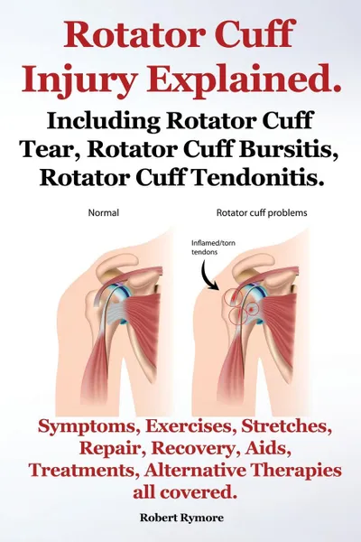 Обложка книги Rotator Cuff Injury Explained. Including Rotator Cuff Tear, Rotator Cuff Bursitis, Rotator Cuff Tendonitis. Symptoms, Exercises, Stretches, Repair, Re, Robert Rymore