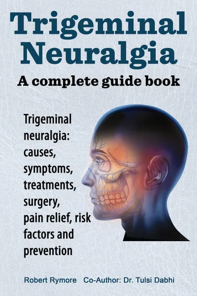 Обложка книги Trigeminal neuralgia. a complete guide book. Trigeminal neuralgia: causes, symptoms, treatments, surgery,, Robert Rymore