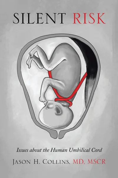 Обложка книги Silent Risk. Issues about the Human Umbilical Cord, Jason H. Mscr Collins MD, MD Mscr Jason H. Collins