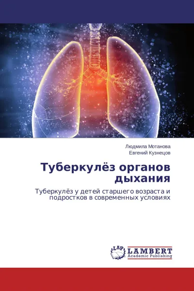 Обложка книги Туберкулёз органов дыхания, Людмила Мотанова, Евгений Кузнецов