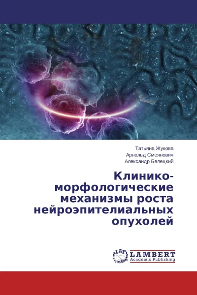 Обложка книги Клинико-морфологические механизмы роста нейроэпителиальных опухолей, Татьяна Жукова,Арнольд Смеянович, Александр Белецкий