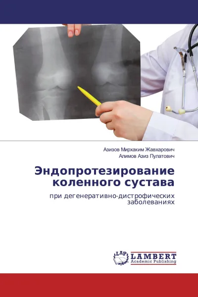 Обложка книги Эндопротезирование коленного сустава, Азизов Мирхаким Жавхарович, Алимов Азиз Пулатович