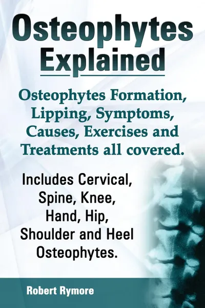 Обложка книги Osteophytes Explained. Osteophytes Formation, Lipping, Symptoms, Causes, Exercises and Treatments All Covered. Includes Cervical, Spine, Knee, Hand, H, Robert Rymore