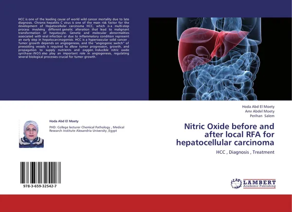 Обложка книги Nitric Oxide before and after local RFA for hepatocellular carcinoma, Hoda Abd El Moety,Amr Abdel Moety and Perihan Salem