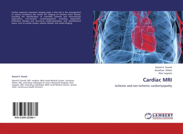 Обложка книги Cardiac MRI, Daniel K. Powell,Jonathan Killam and Alan Legasto