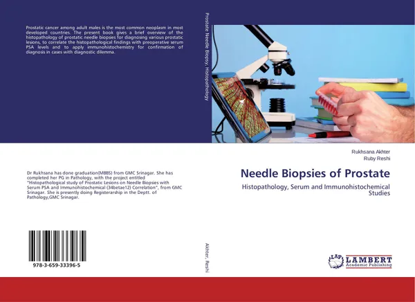 Обложка книги Needle Biopsies of Prostate, Rukhsana Akhter and Ruby Reshi