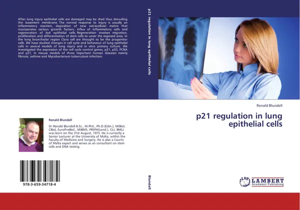 Обложка книги p21 regulation in lung epithelial cells, Renald Blundell