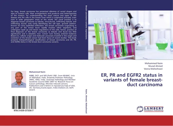 Обложка книги ER, PR and EGFR2 status in variants of female breast-duct carcinoma, Mohammed Naim,Murad Ahmed and Veena Maheshwari