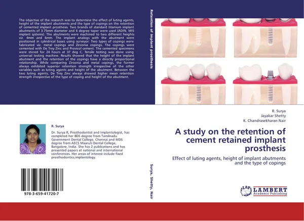 Обложка книги A study on the retention of cement retained implant prosthesis, R. Surya,Jayakar Shetty and K. Chandrasekharan Nair