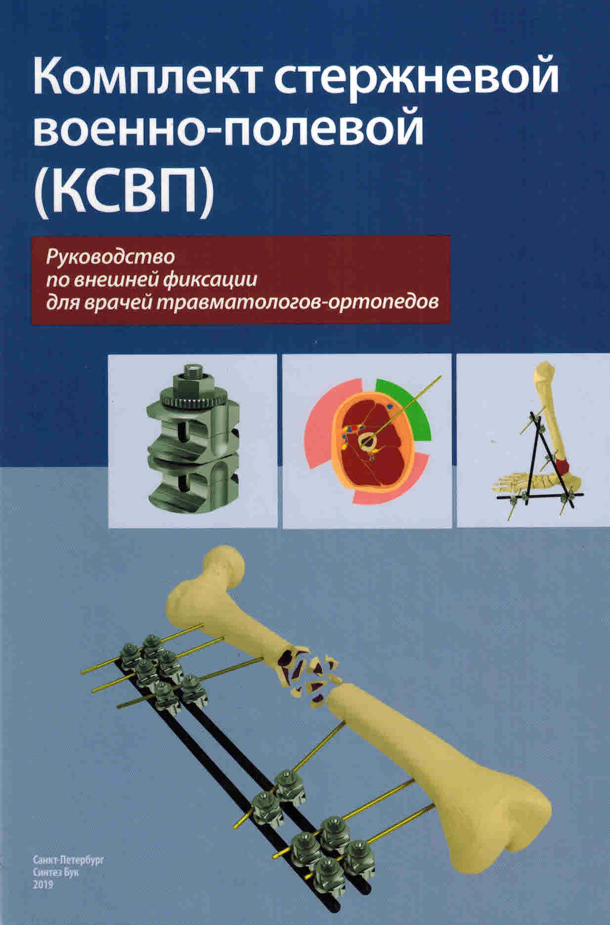 Комплект стержневой военно-полевой (КСВП): руководство по внешней фиксации  для врачей травматологов-ортопедов | Хоминец Владимир Васильевич - купить с  доставкой по выгодным ценам в интернет-магазине OZON (474875819)