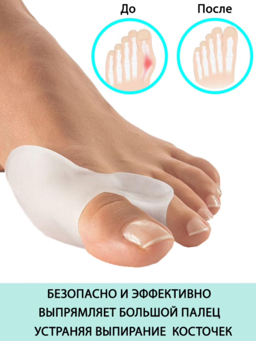 Характеристики Вальгусная накладка на большой палец ноги/Фиксаторы ...