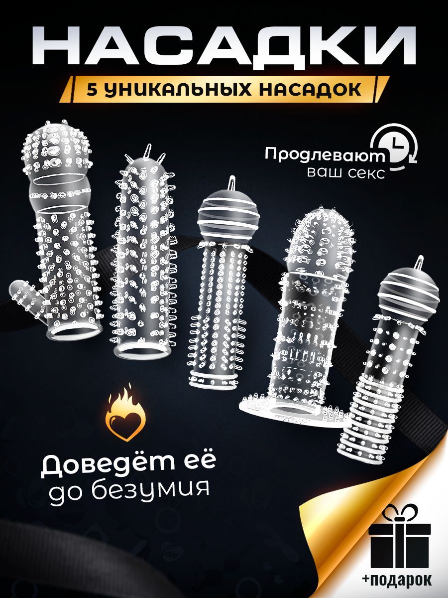 Ортодонтическая коррекция аппаратом с винтом Хайрекса Ортодонтическая коррекция аппаратом с винтом Хайрекса