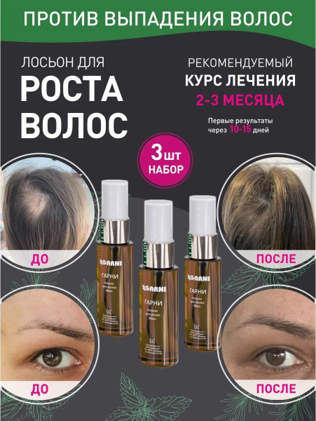 Garni растительный лосьон для роста волос и против выпадения - купить с ...