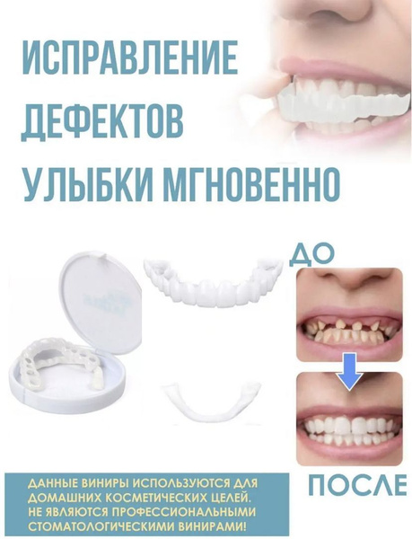 Виниры накладные для формирования зуба - купить с доставкой по выгодным ...