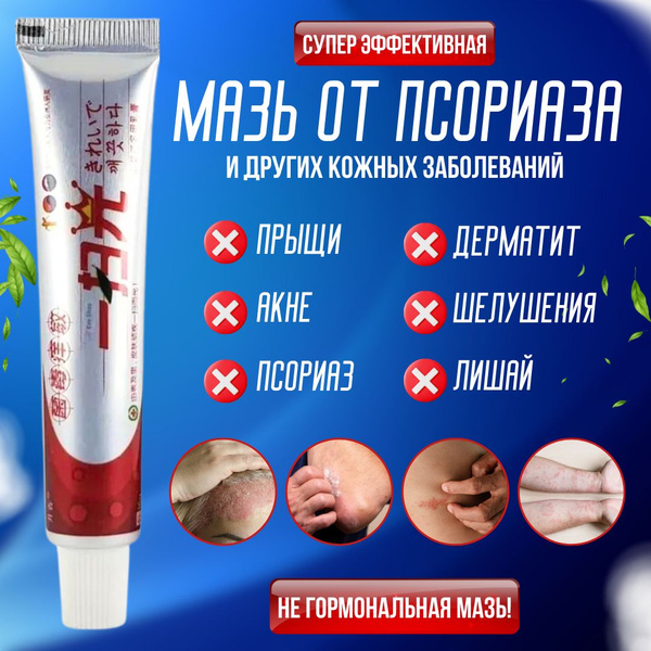 Мазь от псориаза ; Китайская чудо мазь / Псориаз , Экзема , Герпес ...