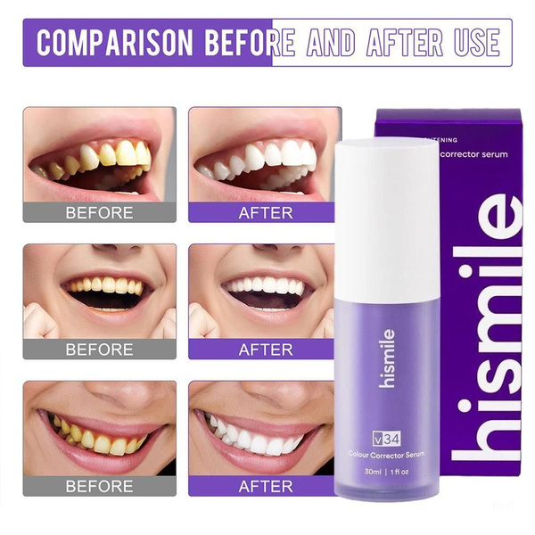 Hismile V34 Фиолетовый отбеливатель для зубов, удаление пятен 30 мл ...