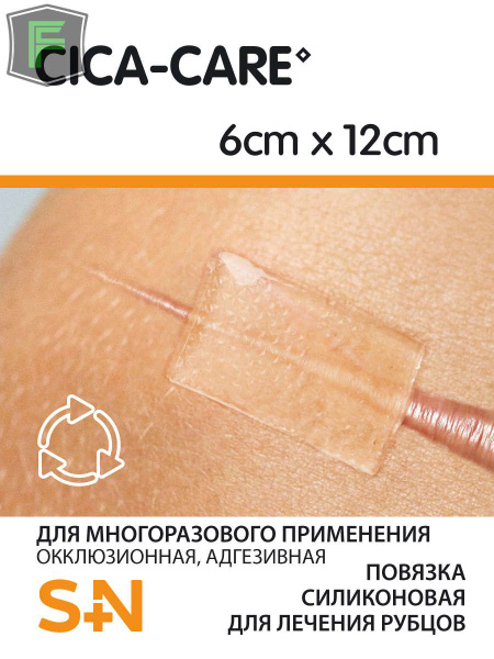 Cica-Care (Сика-Кеа) - Пластырь моделируемый противорубцовый из ...