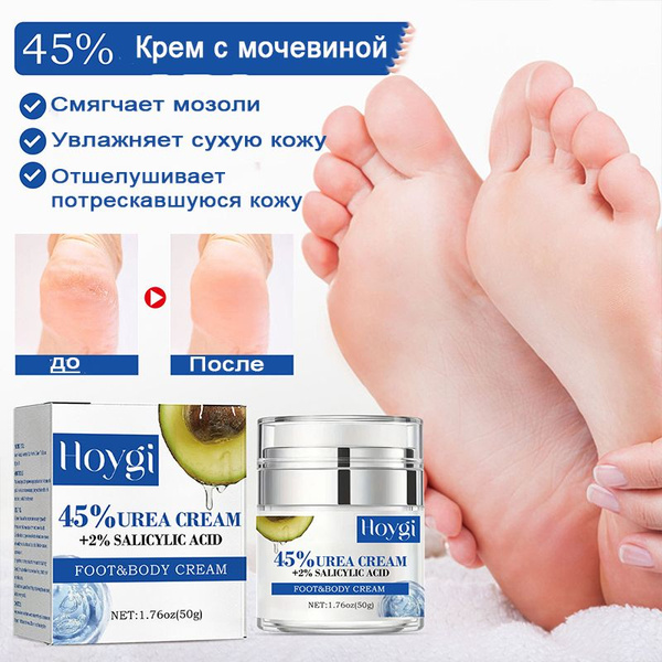 Крем для тела, рук и ног с мочевиной 45%, увлажняющий и питательный ...