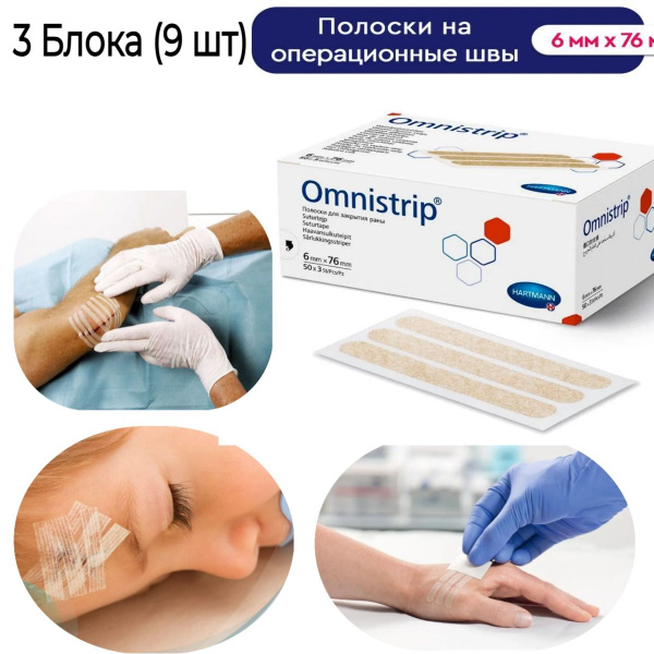 Полоски пластырные Омнистрип (Omnistrip) стерильные на операционные швы ...
