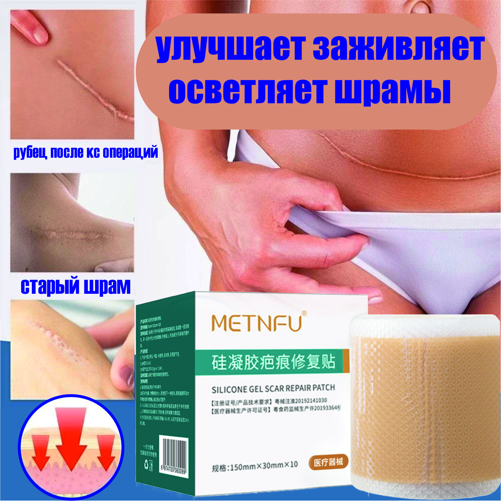 Пластырь От Рубцов Купить В Москве