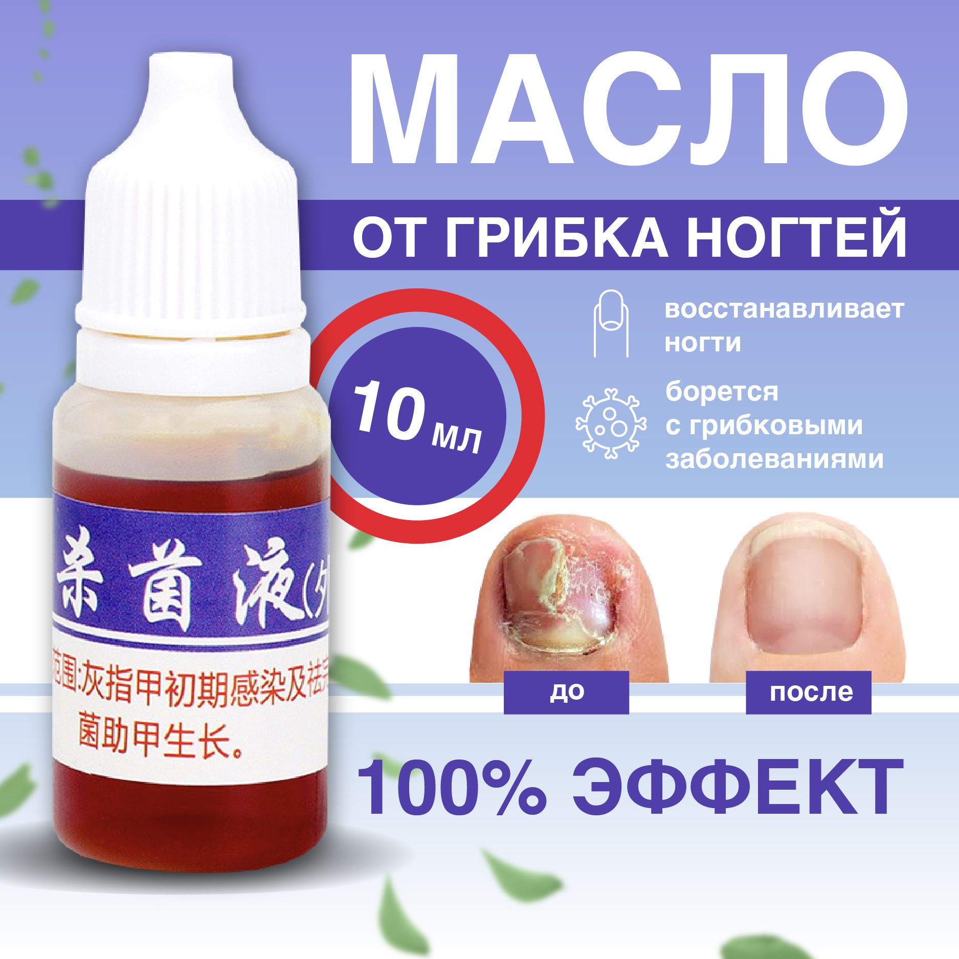 Масло для ногтей средство для лечения грибка "Nice Nails", средство от грибка ногтей на ногах, лечение онихолизиса