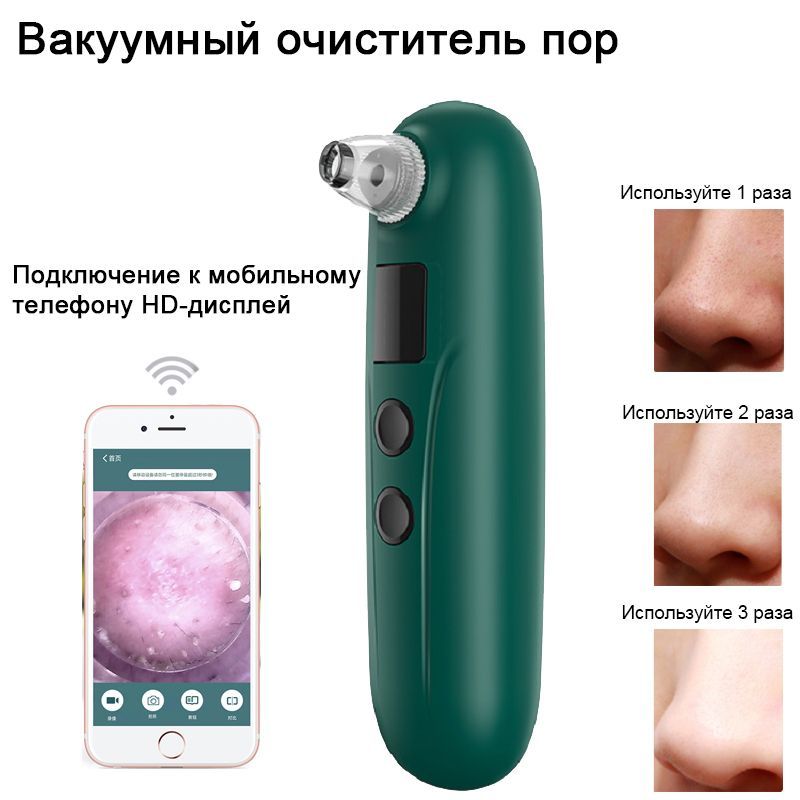 Вакуумный очиститель лица MyPads