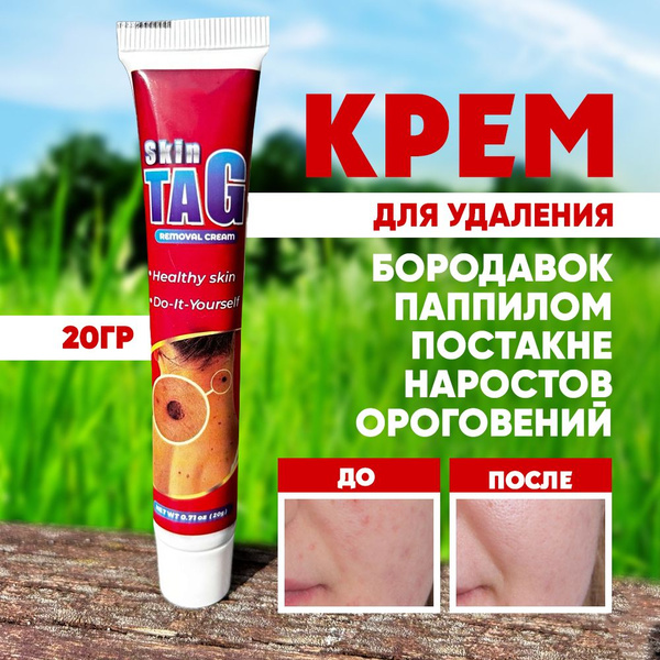 Крем от папиллом и бородавок - купить с доставкой по выгодным ценам в ...