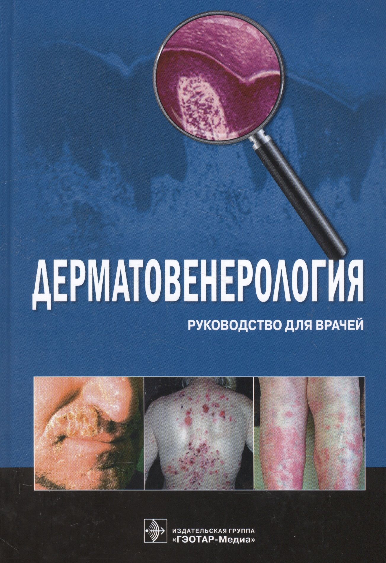 Бутов дерматовенерология. Бутов дерматовенерология. Бутов дерматовенерология. Бутов дерматовенерология. Дерматовенерология книга.