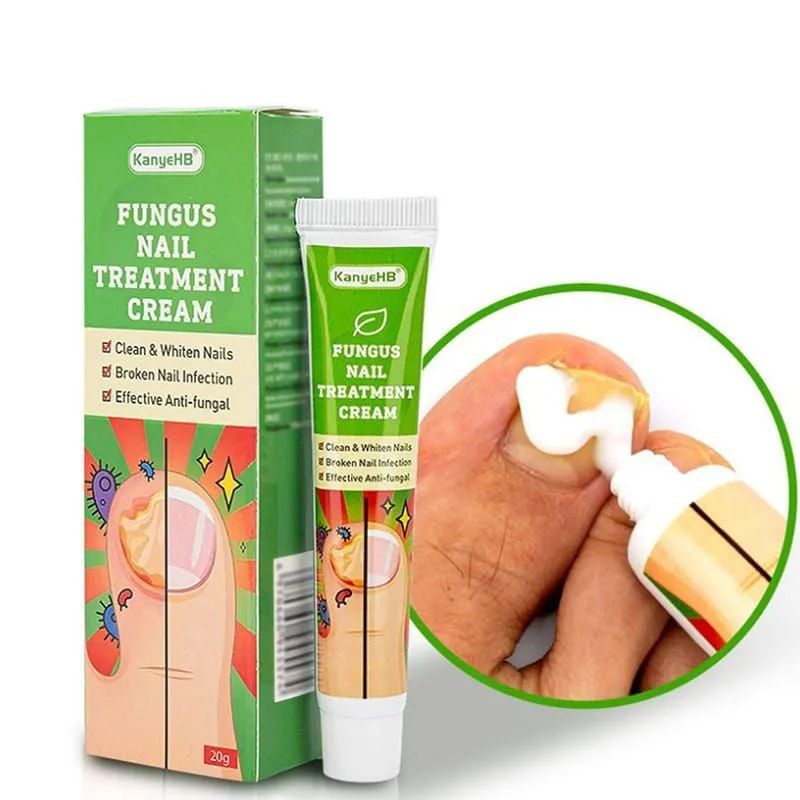 Антибактериальный крем для ногтей детям. Fungus treatment cream. Противогрибковые мази для ногтей. Эферо. Vibrant glamour крем.