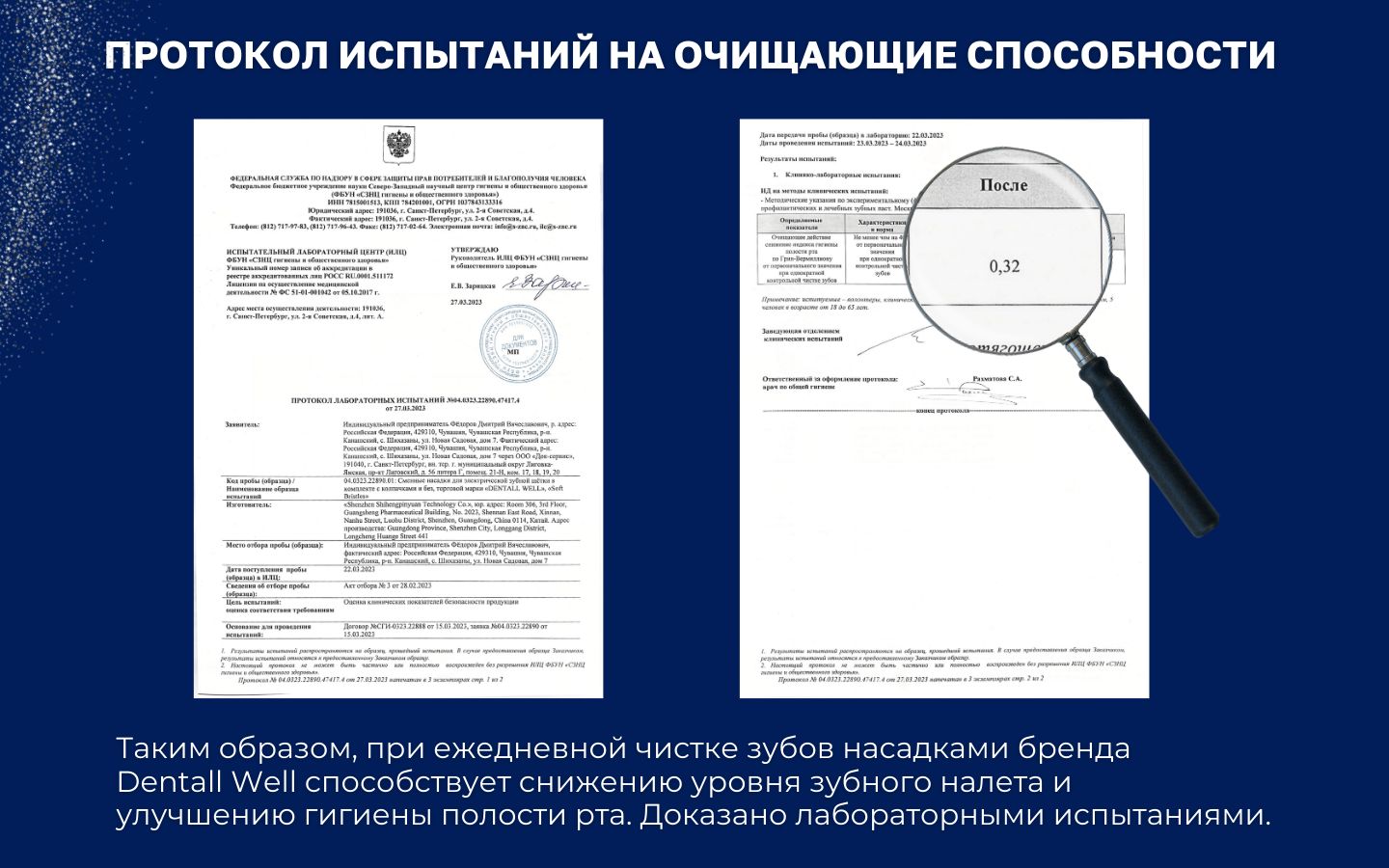 Сменные насадки Cross Clean SB-50A с защитными колпачками для электрич(图4)