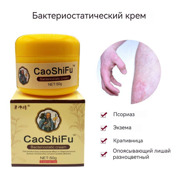 Мазь Крем от ПСОРИАЗА, экземы, атопического дерматита / Крем от ...