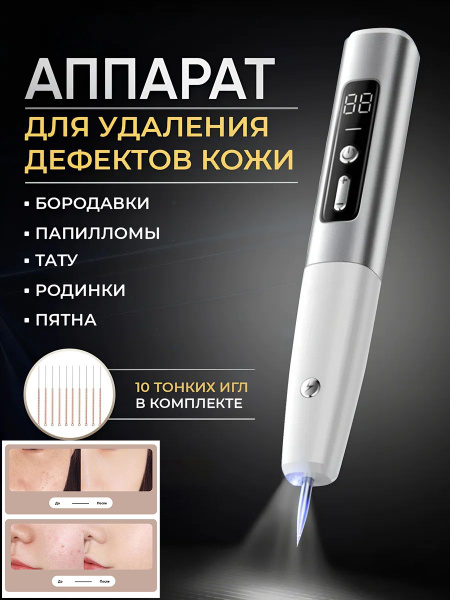 Косметологический аппарат Плазменная ручка для удаления родинок ...