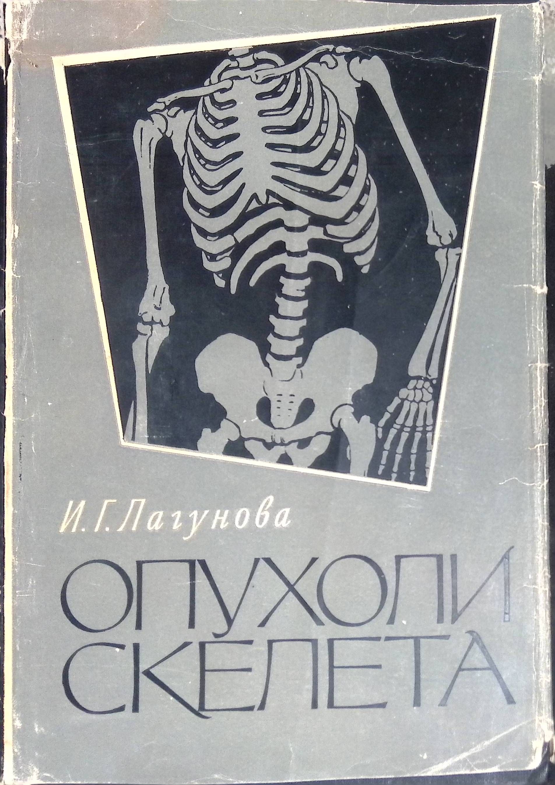 Опухоли скелета (б/у)