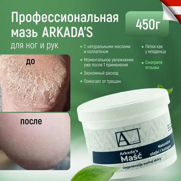 Аркада мазь 450 г, для сухой кожи ног, рук, от трещин, мозолей ...