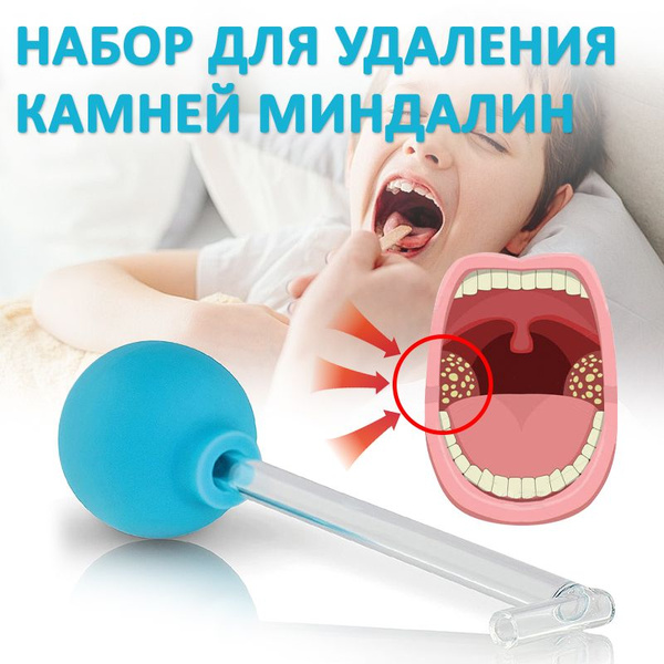 Набор для удаления камней миндалин - купить с доставкой по выгодным ...