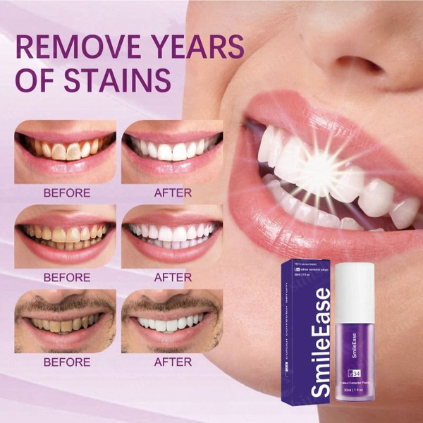 1шт SmileEase V34 Фиолетовый отбеливатель для зубов и пятновыводитель ...