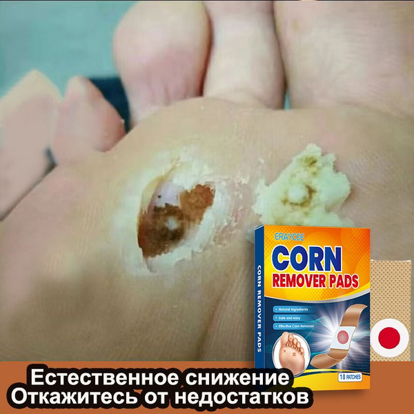 Пластырь от сухих мозолей и натоптышей 10 наклеек. Пластырь от сухих ...