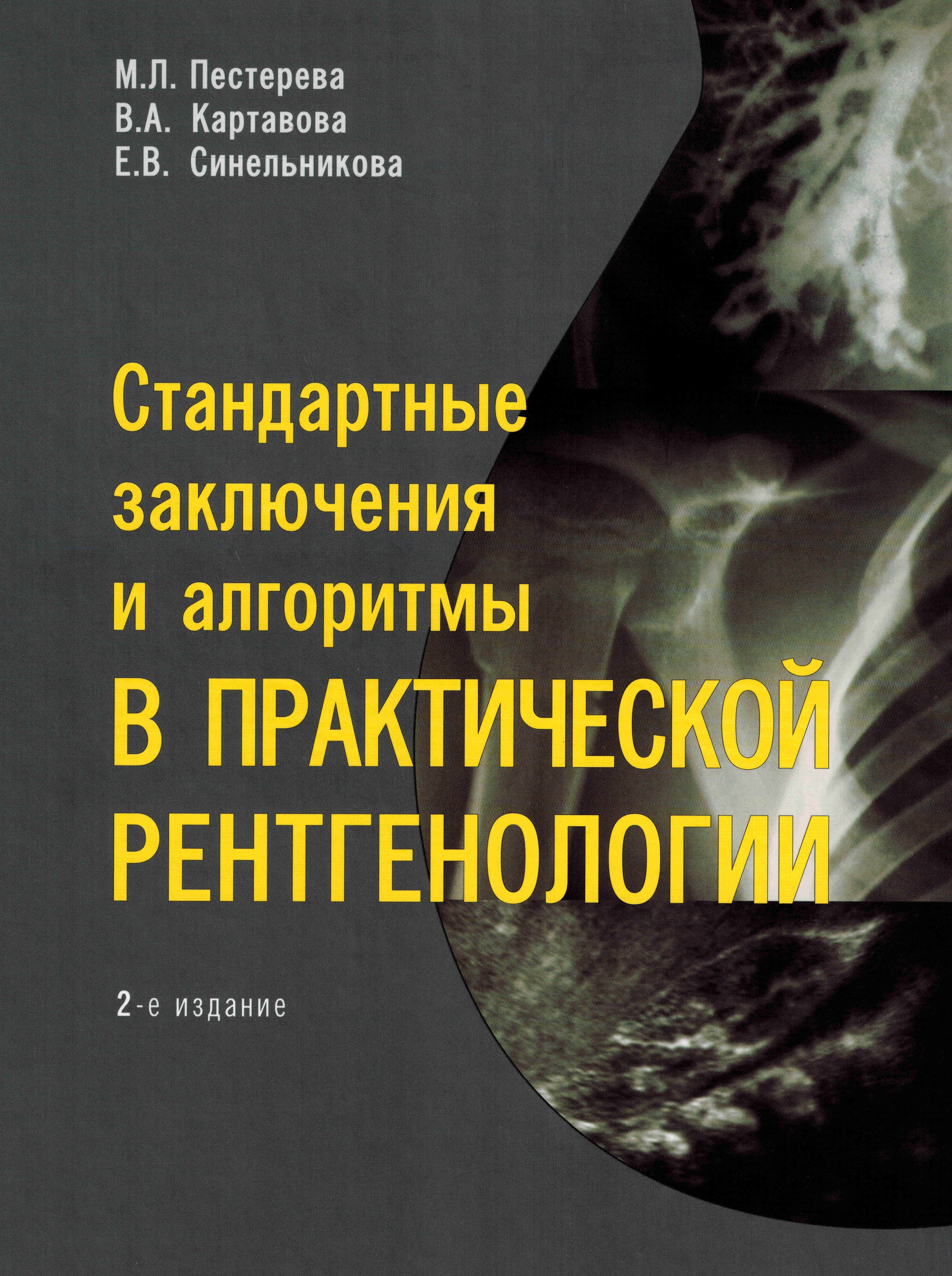 Стандартные заключения и алгоритмы в практической рентгенологии | Пестерева М. Л., Картавова В. А.