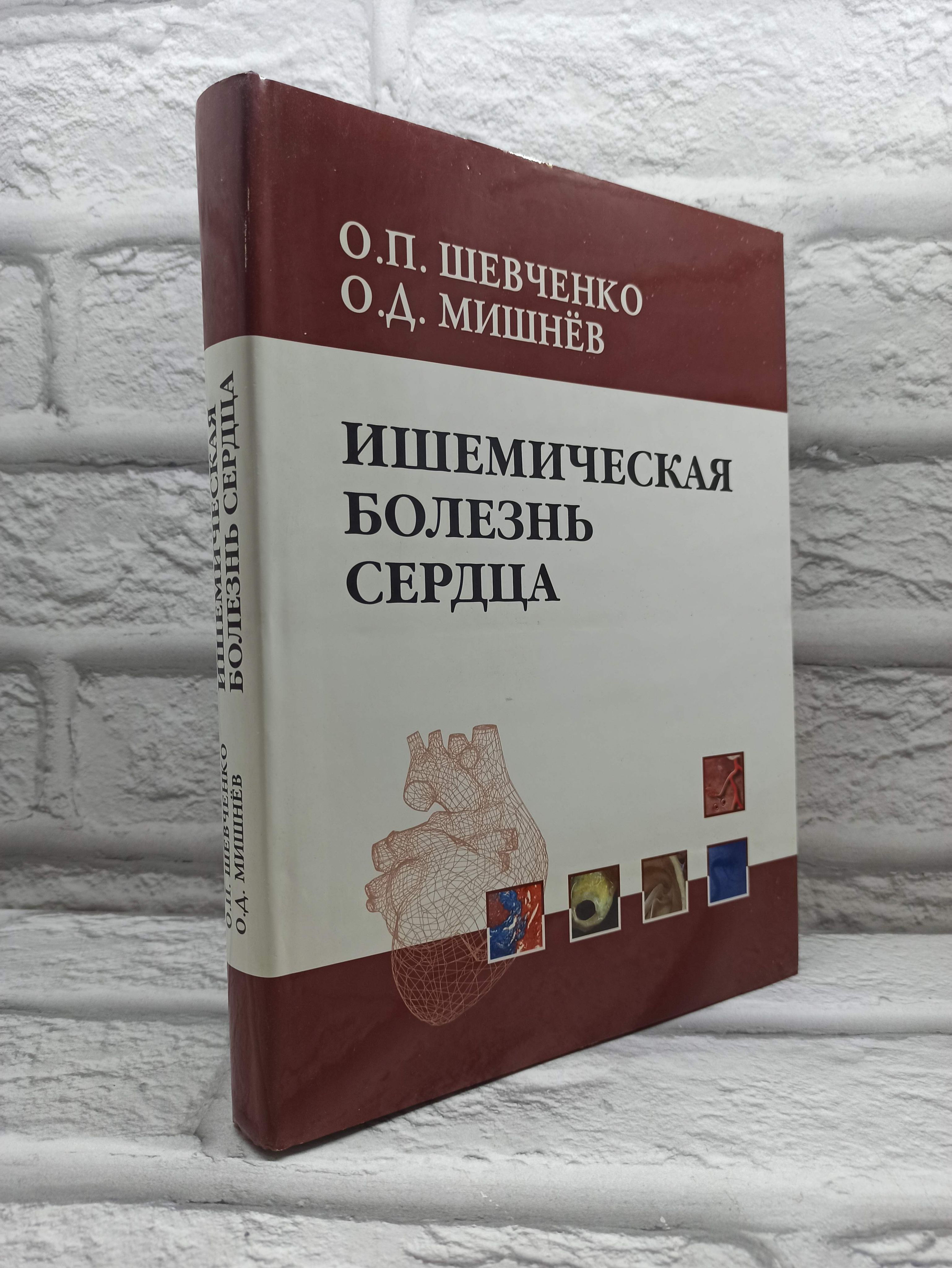 Ишемическая болезнь сердца