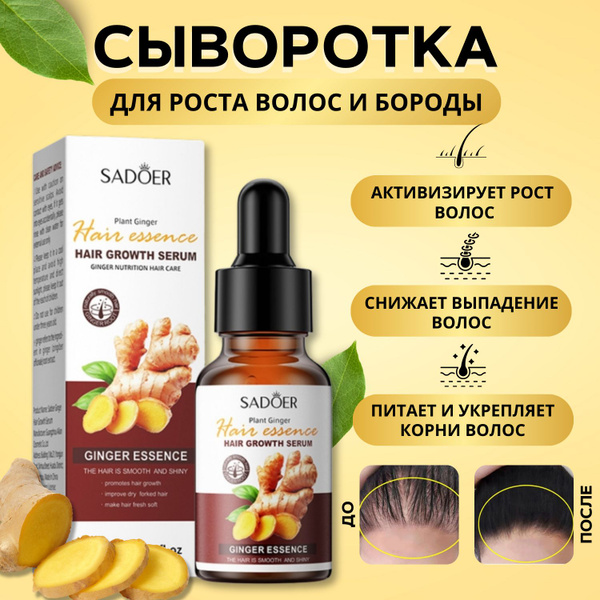 Сыворотка для роста волос для мужчин и женщин / лосьон от выпадения ...