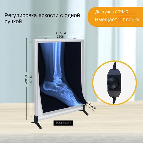 Негатоскоп однокадровый светодиодный медицинский - купить с доставкой ...