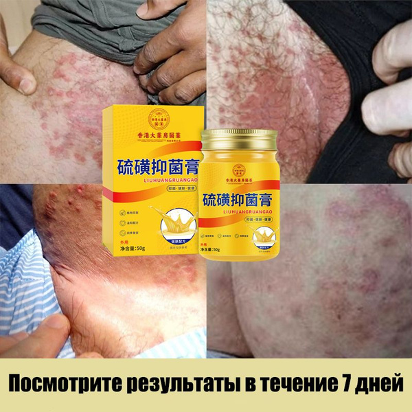 Антибактериальный против кожных заболеваний с зуда чудо мазь 50г ...