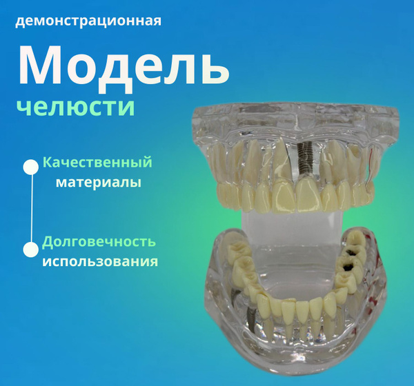 Демонстрационная модель челюсти - купить с доставкой по выгодным ценам ...