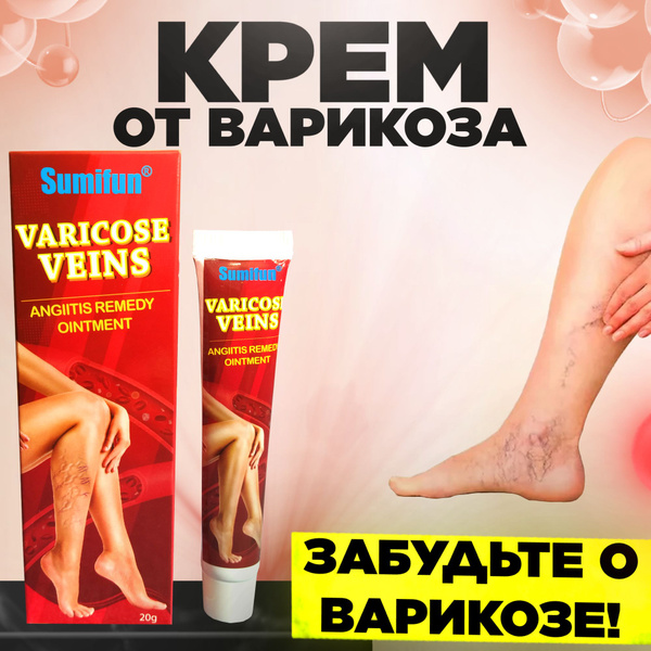 Крем от варикоза, усталости и отеков ног Sumifun - купить с доставкой ...