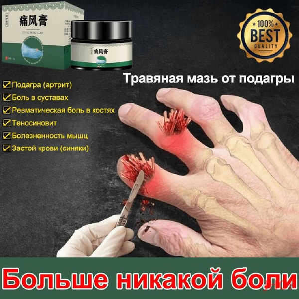Мазь от подагры, для ног и коленного сустава, крем от боли в суставах ...