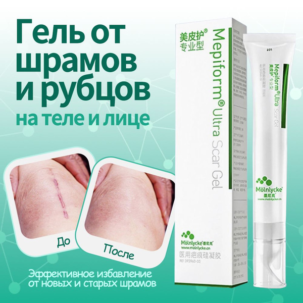 Мепиформ (Mepiform) Заживляющий гель от шрамов, рубцов, ожогов ...