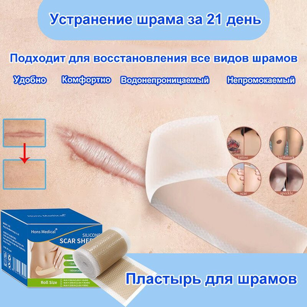 Силиконовый пластырь от шрамов и рубцов, для профилактики и заживления ...